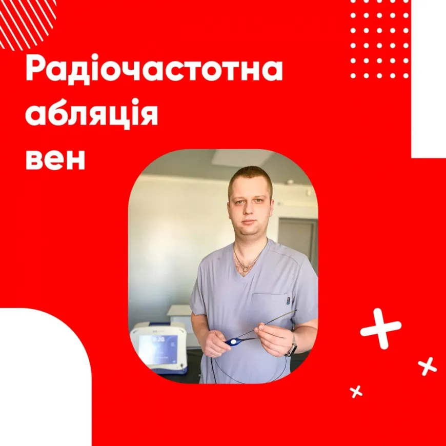 Радіочастотна абляція вен