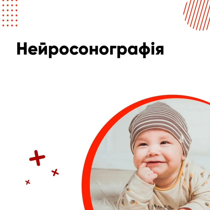 Нейросонографія. Для чого проводити?