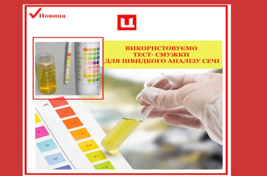 Швидка діагностика аналізу сечі