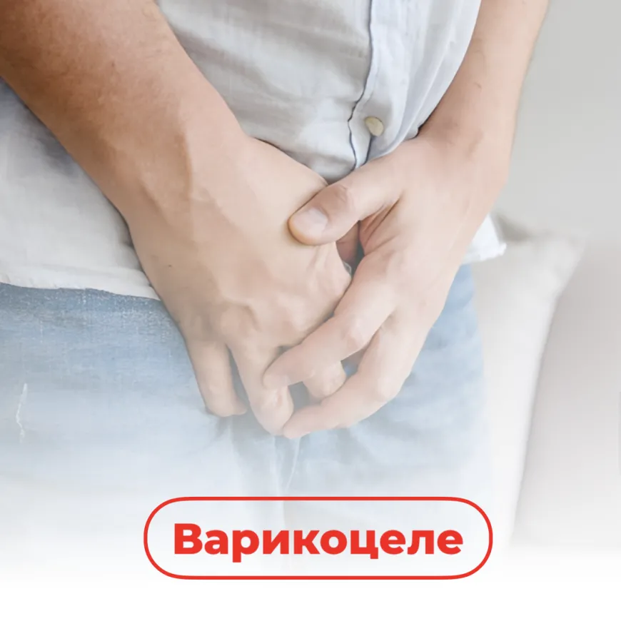 Варикоцеле Доктор Царук