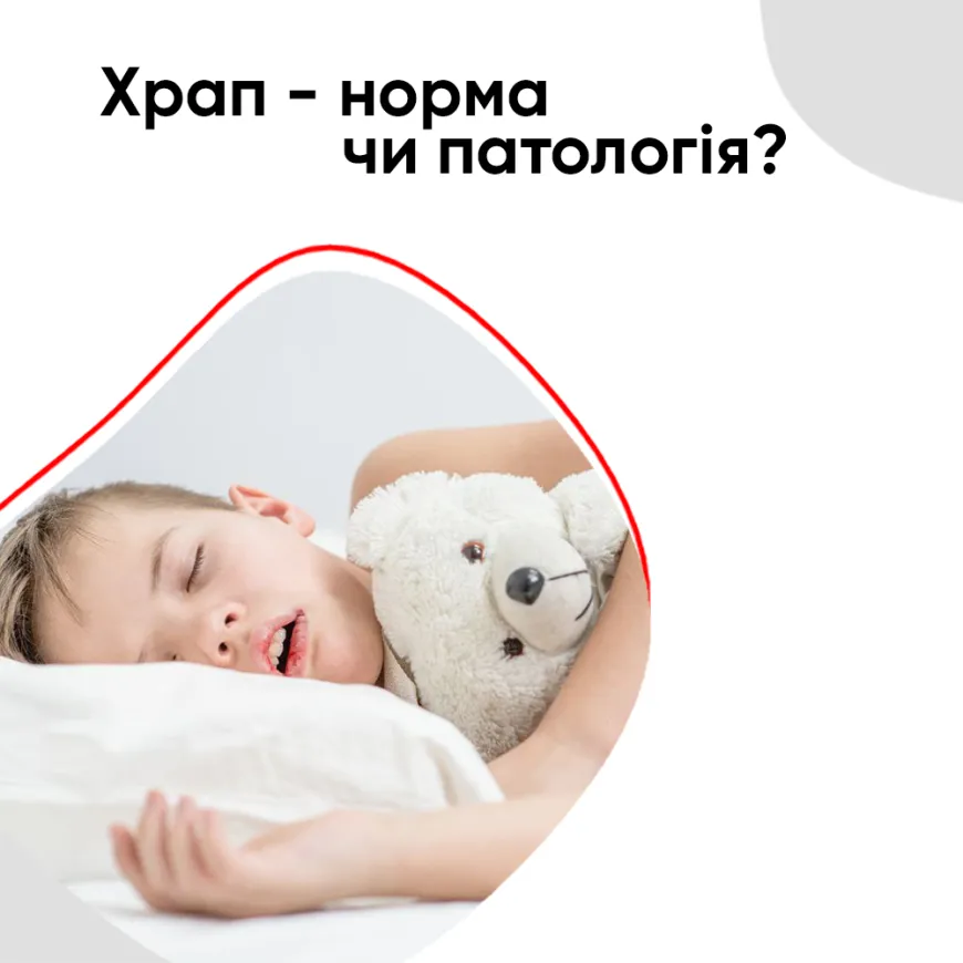 Храп - норма чи патологія?