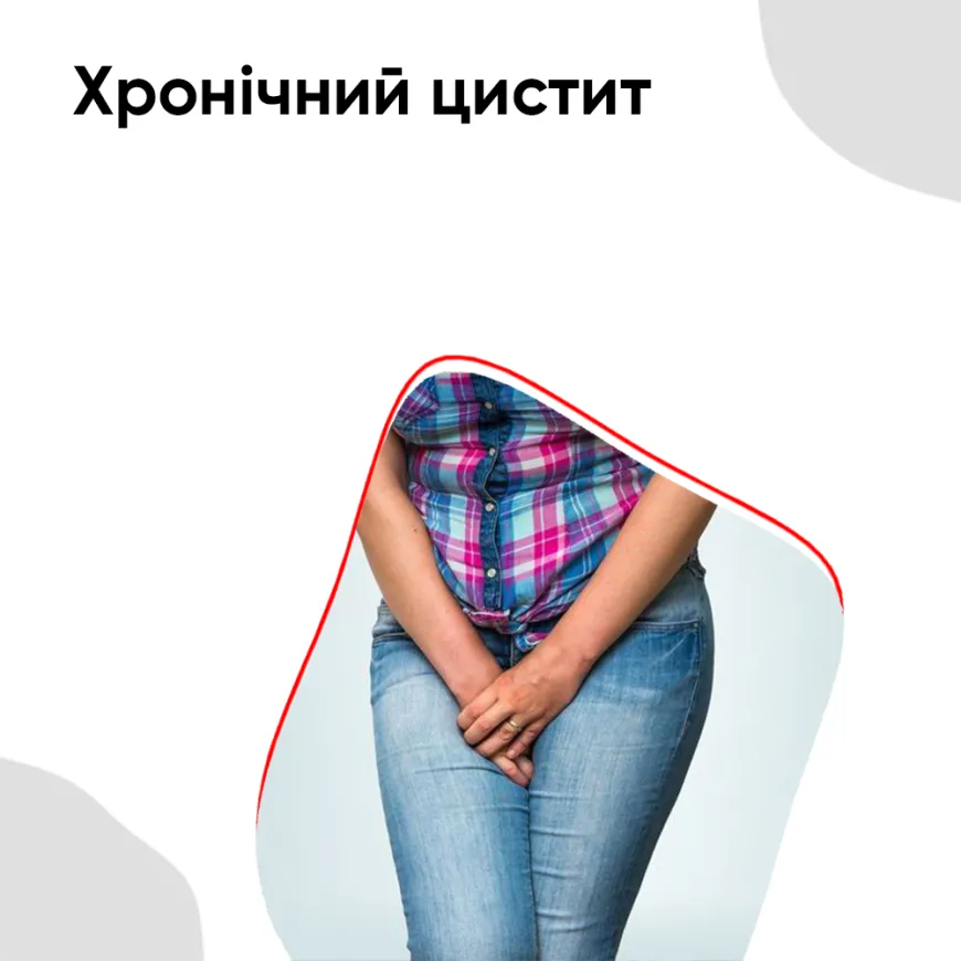 Хронічний цистит