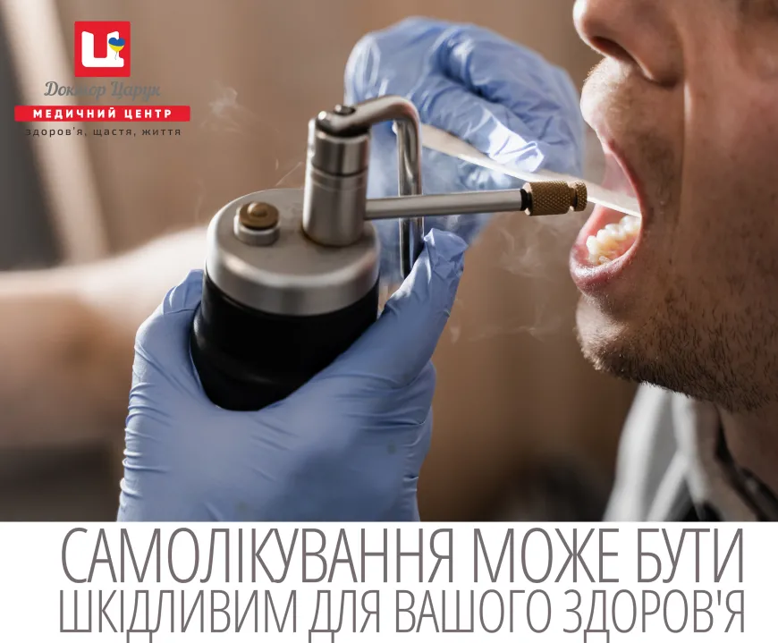 Кріотерапія мигдаликів