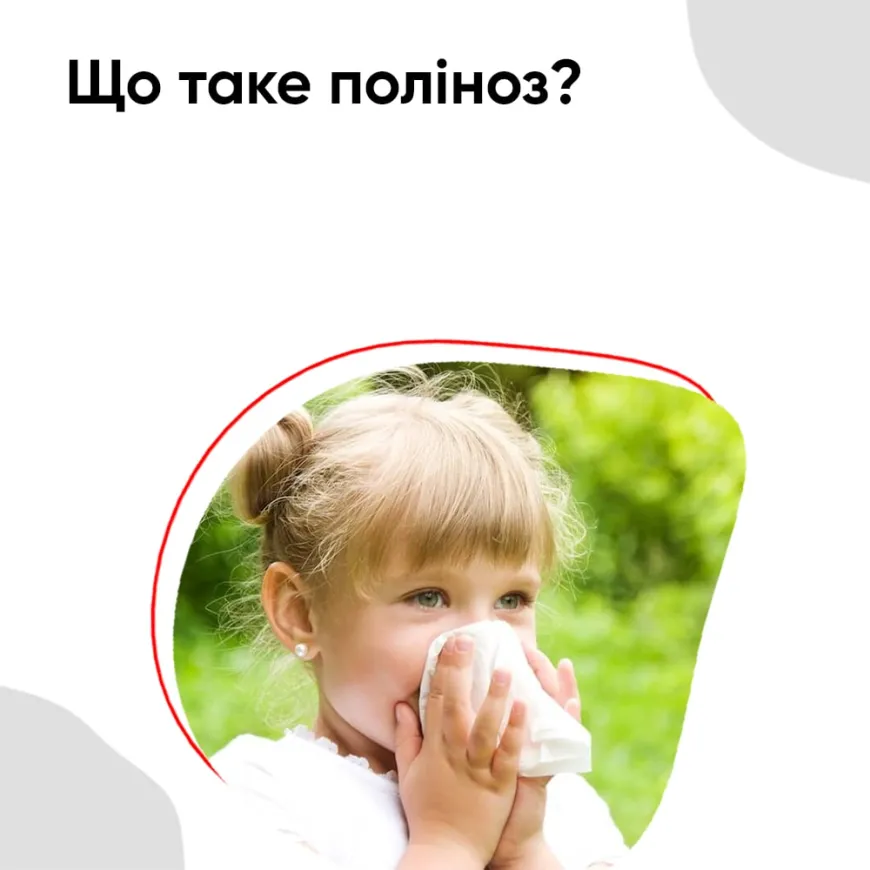 Що таке поліноз?