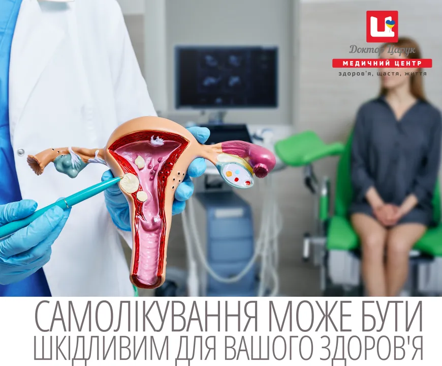 Поліпи шийки матки: все, що варто знати жінкам