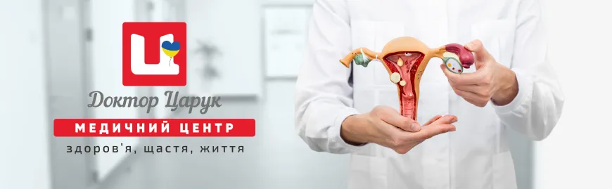 Ендометріоз матки: лікування та профілактика