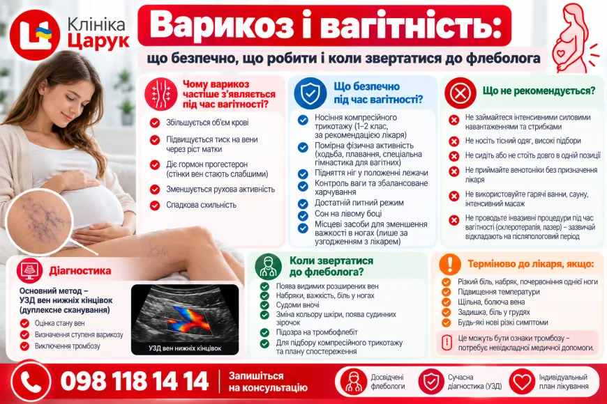 Варикоз і вагітність