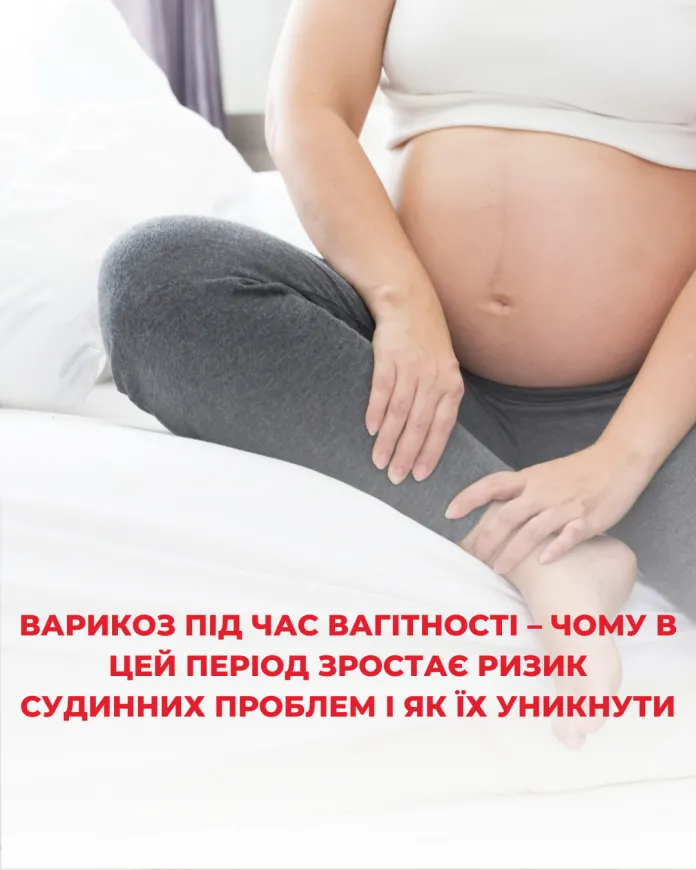 Флеболог для вагітних