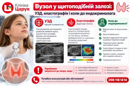 Вузол у щитоподібній залозі