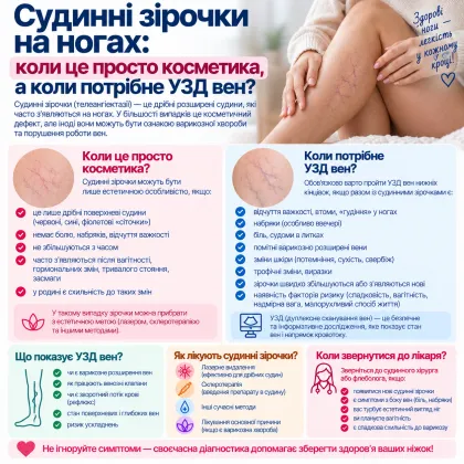 Судинні зірочки на ногах: коли це просто косметика, а коли потрібне УЗД вен
